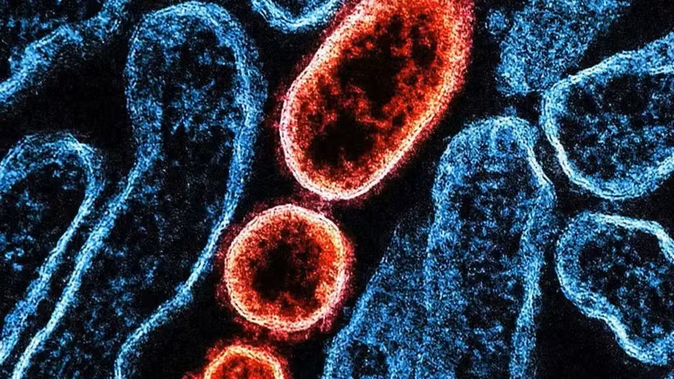 Índia registra novo surto do vírus Nipah e países da Ásia entram em alerta india-registra-novo-surto-do-virus-nipah-e-paises-da-asia-entram-em-alerta