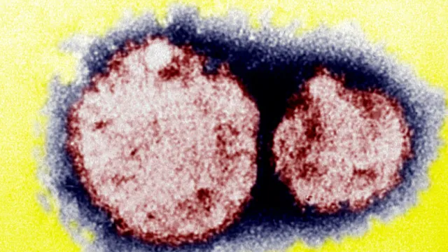 Hantavírus é comum em países como o Brasil e é transmitido por roedores silvestres hantavirus-e-comum-em-paises-como-o-brasil-e-e-transmitido-por-roedores-silvestres