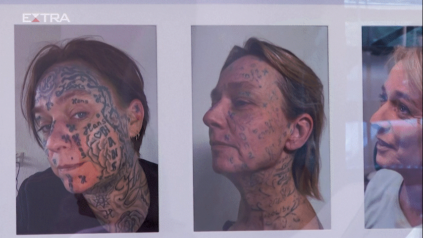 Holandesa começa a remover 250 tatuagens feitas à força por ex-namorado holandesa-comeca-a-remover-250-tatuagens-feitas-a-forca-por-ex-namorado