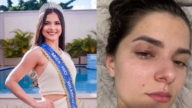 Empresário é condenado por agredir ex-Miss Universo após crise de ciúmes empresario-e-condenado-por-agredir-ex-miss-universo-apos-crise-de-ciumes
